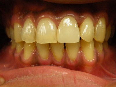 DSCF5229.JPG