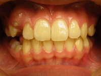 DSCF2296.JPG