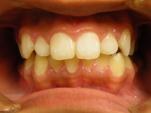 DSCF5997.JPG