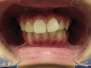 IMG_4425.JPG