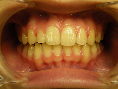 DSCF6634.JPG