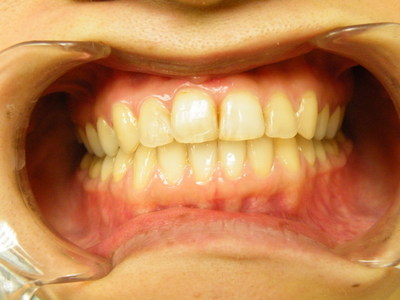 DSCF8512.JPG