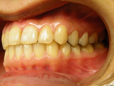 DSCF8520.JPG