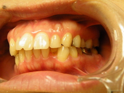 DSCF9870.JPG