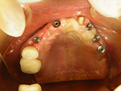 DSCF9954.JPG
