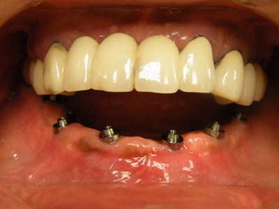 DSCF1792.JPG