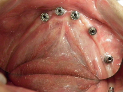 DSCF2456.JPG