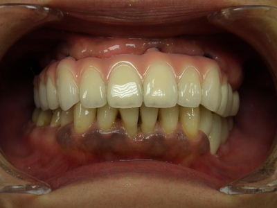 DSCF2526.JPG