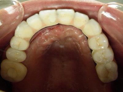 DSCF2534.JPG