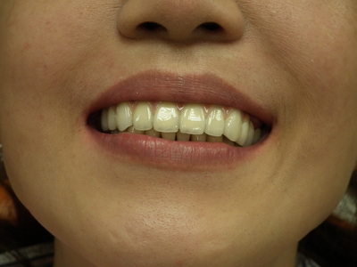 DSCF2540.JPG