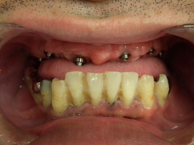 DSCF2841.JPG