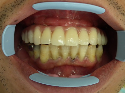 DSCF2847.JPG