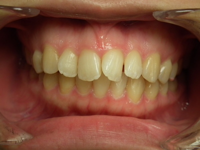 DSCF2940.JPG