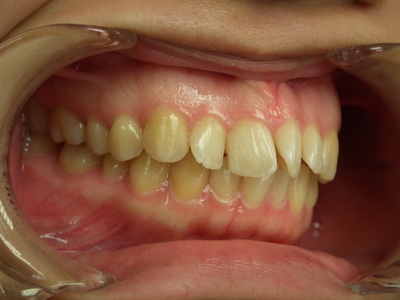 DSCF2941.JPG