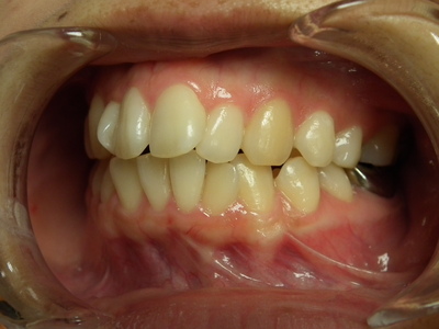 DSCF3140.JPG