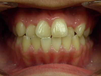 DSCF3166.JPG