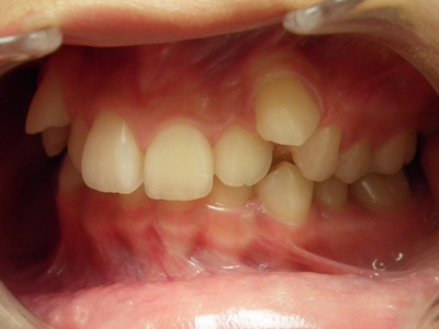 DSCF3228.JPG