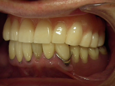 DSCF4030.JPG