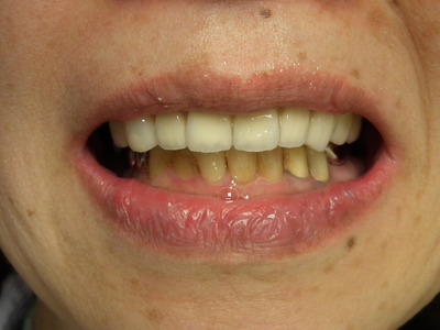 DSCF4242.JPG