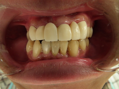 DSCF4280.JPG