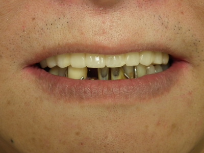DSCF4427.JPG