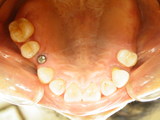 DSCF0889