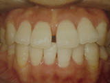 5a8507d7.JPG