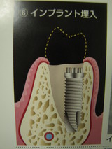 7b1f3e34.JPG