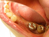 DSCF0996