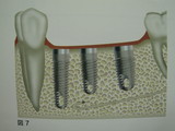 9fa4b112.JPG