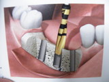DSCF1477