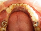 DSCF0992