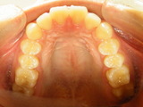 DSCF1035