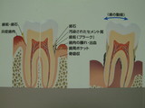 gura